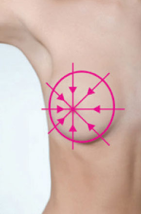 Samovyšetření prsu - klínovité